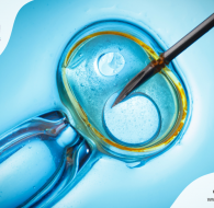 الحقن المجهري | أهم 5 مراحل للعملية بالتفصيل 2022