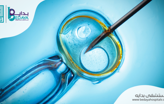 الحقن المجهري | أهم 5 مراحل للعملية بالتفصيل 2022 الحقن المجهري | أهم 5 مراحل للعملية بالتفصيل 2022